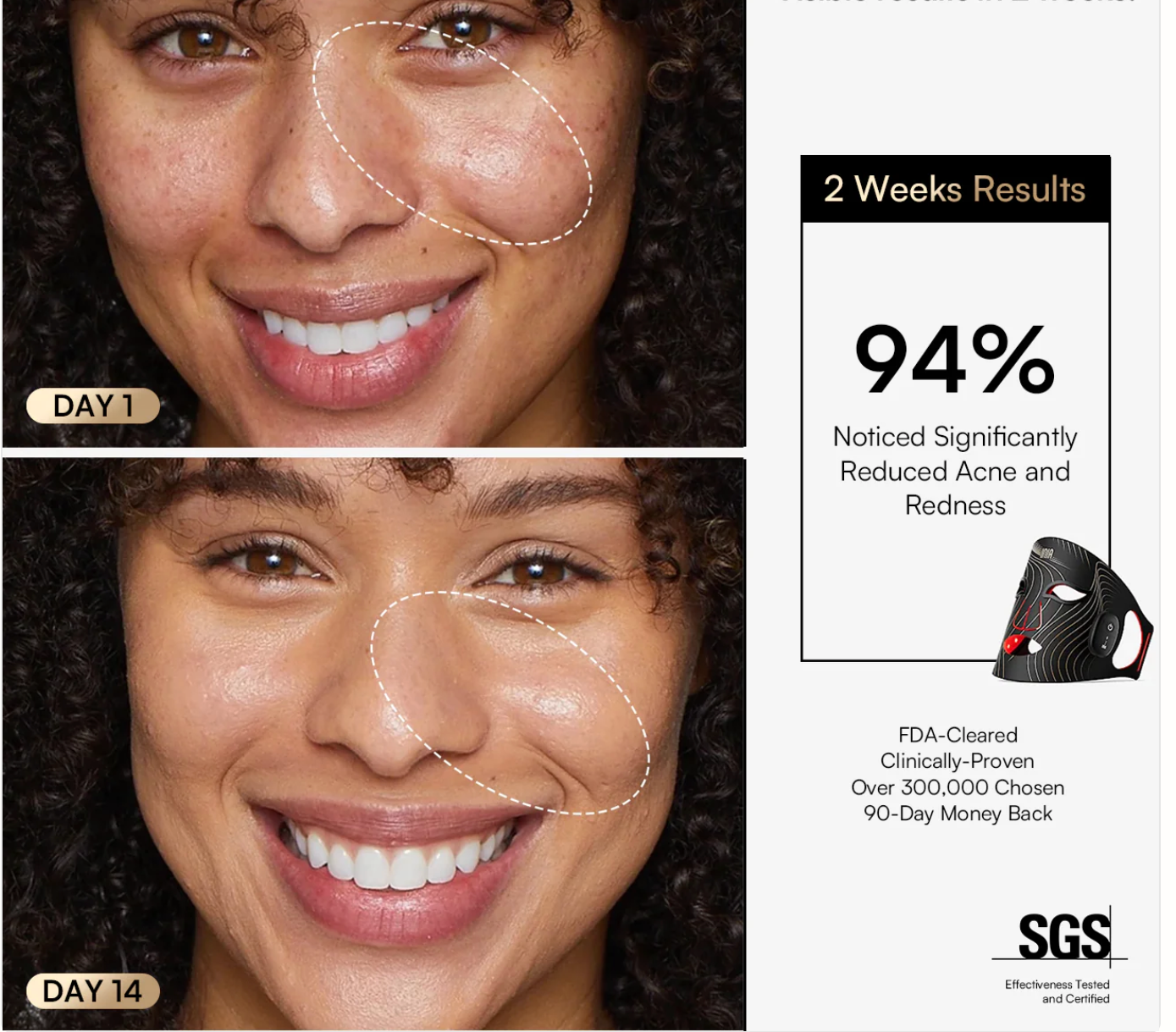 SINA GLOW Wireless LED Face Mask